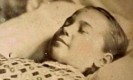 post-mortem1