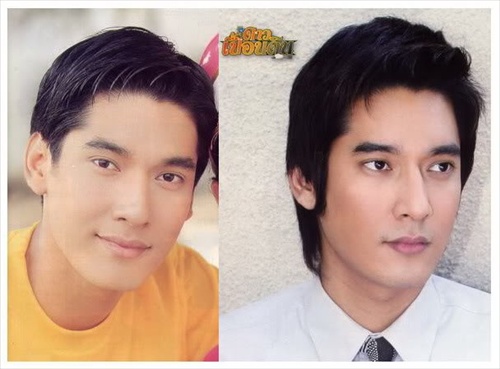 ศัลยกรรม