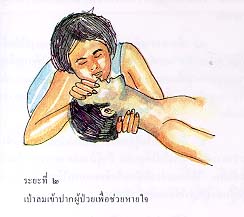 หัวใจหยุดเต้น