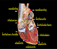 กายภาพของหลอดเลือดหัวใจตีบและการรักษา
