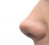 การเสริมจมูก (Rhinoplasty)