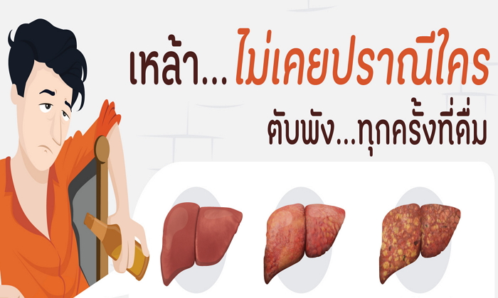 อันตราย! ทุกครั้งที่ดื่มเหล้า “ตับตาย” ไม่รู้ตัว