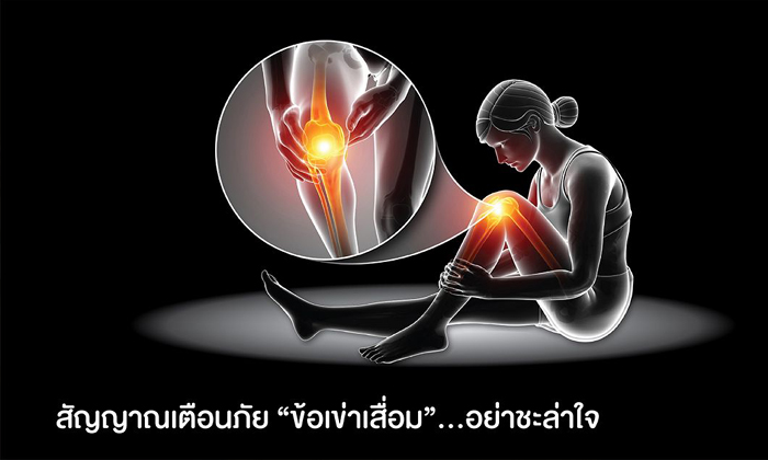 สัญญาณเตือนภัย “ข้อเข่าเสื่อม”...อย่าชะล่าใจ