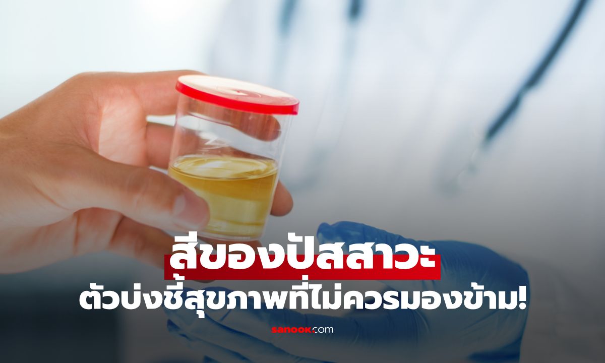สีของปัสสาวะ ตัวบ่งชี้สุขภาพที่สำคัญที่คุณไม่ควรมองข้าม!