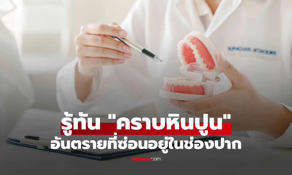 หินปูนไม่ใช่แค่คราบเหลือง! รู้ทันอันตรายที่ซ่อนอยู่ในช่องปาก