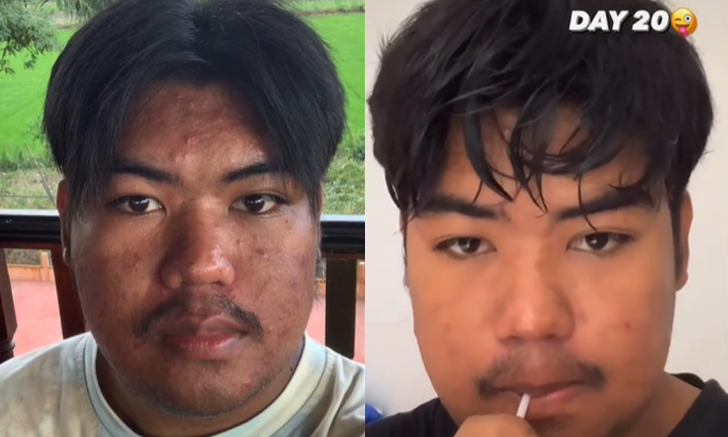 หนุ่มรีวิวลองกินน้ำมะเขือเทศติดต่อกัน 21 วัน ผลลัพธ์เป็นยังไงมาดู