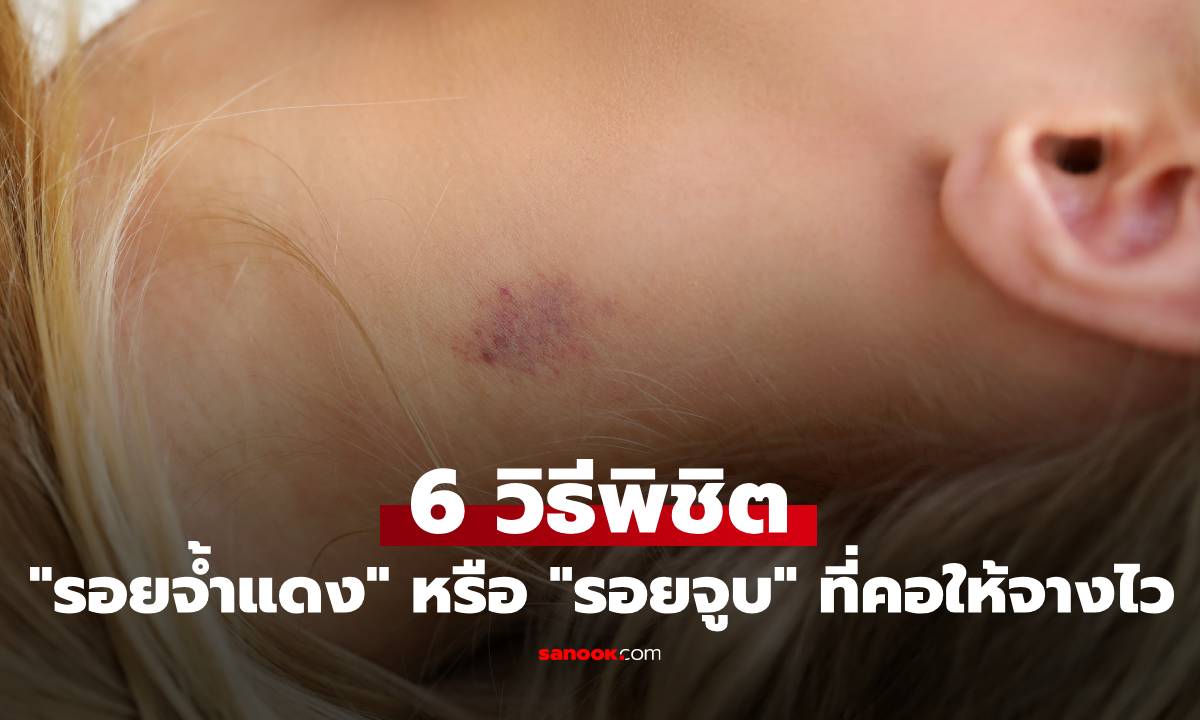 6 วิธีพิชิต \