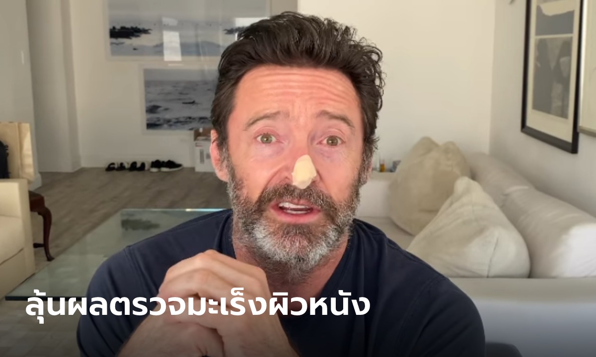 Hugh Jackman ลุ้น! เผยกำลังรอผลตรวจมะเร็งผิวหนัง วอนทุกคนทากันแดด