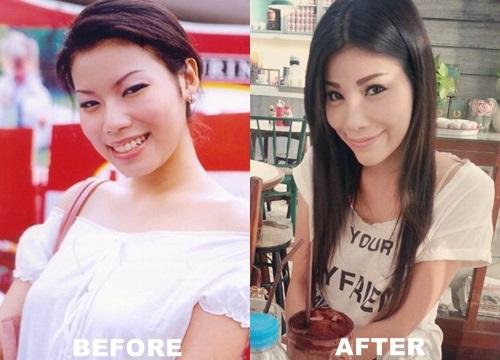 แหวนแหวน ปวริศา เพ็ญชาติ ศัลยกรรมความสวยจากภายใน